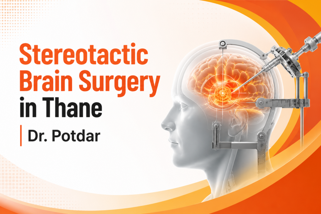 Stereotactic Brain Surgery in Thane