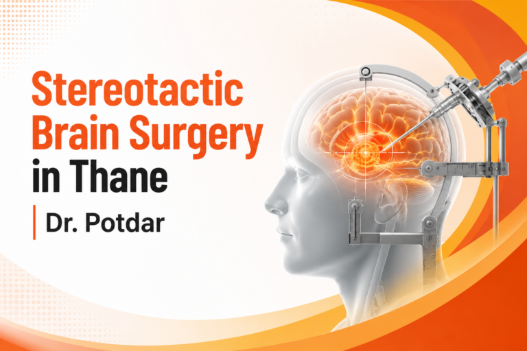 Stereotactic Brain Surgery in Thane